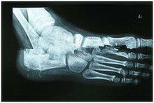 da imagem latente diagnóstica Degradable de X Ray de 13in x de 17in papel médico para a impressora a laser