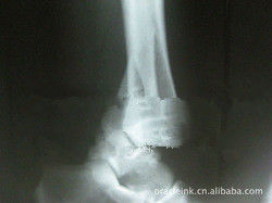 Good price Imagem latente médica Branca 8in x 10in do laser X Ray do Livro impermeável on-line
