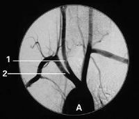 Good price Filmes médicos de X Ray de Konida on-line
