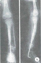 Good price X Ray médico seco impermeável filma Konida lustroso para AGFA/Fuji on-line