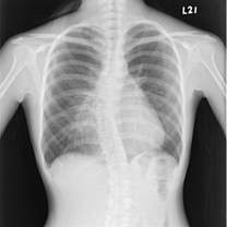 Good price 10 X12 polegada X Ray Medical Imaging on-line