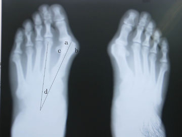 Good price Imagem latente impermeável do diagnóstico de X Ray on-line