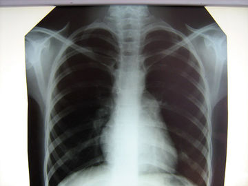 Filme de raio X médico claro Konida do hospital com impressoras térmicas