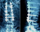 Good price Filme seco médico da imagem latente da baixa névoa de Konida para o exame de X Ray on-line