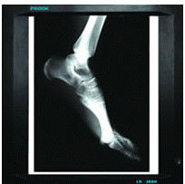 imagem latente diagnóstica médica de 20cm x de 25cm, papel do filme X Ray da impressora a laser