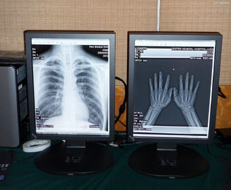 Good price exposição médica da cor 2MP de alta qualidade médica on-line