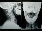Good price Filme high-density X Ray da imagem latente médica seco para Fuji 3000/2000/1000 on-line