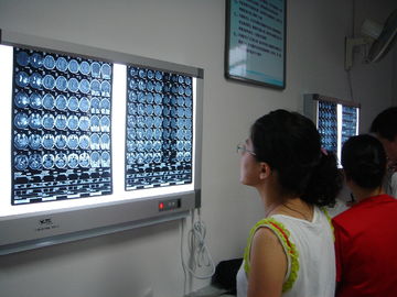 Good price Filme seco médico seco 10in x 12in de X Ray do laser para impressoras de Fuji on-line