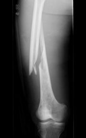 Imagem latente médica do laser X Ray de Konida