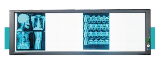 Good price Caixa de visualização super brilhante LED para uso médico on-line