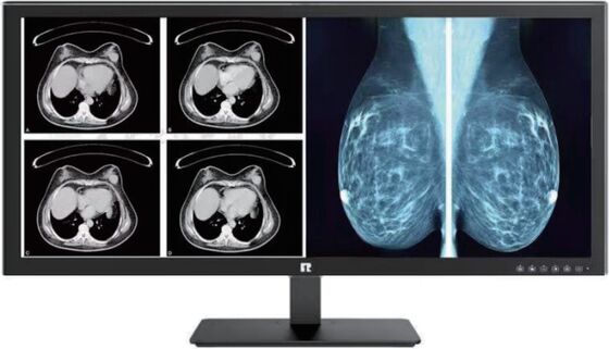 Bom preço Display médico de alta definição para imagens médicas de precisão e monitoramento de cuidados de saúde on-line