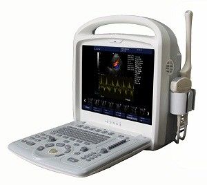 Portable Completo-digital do sistema do ultrassom de Doppler da cor 15inch com software 3D/4D
