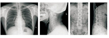 Equipamento móvel de alta frequência da radiografia de Digitas, equipamento médico portátil de X Ray