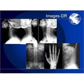 Good price Máquina da radiografia de Digitas do RAIO X de Mammogrpahy com o braço flexível do UC on-line