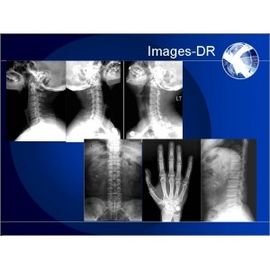 Máquina da radiografia de Digitas do RAIO X de Mammogrpahy com o braço flexível do UC