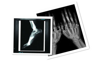 O filme X Ray médico do ANIMAL DE ESTIMAÇÃO de Hosipital de papel Waterproof o branco do filme de 8 CT da polegada ×10