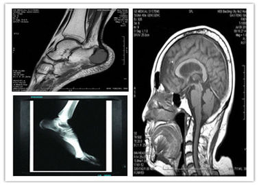 Good price Filme seco baixo azul médico da imagem latente de Digitas varredura compatível de 8 x de 10in Hosipital Mri on-line