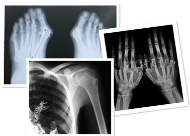 Good price Filme térmico Fuji de X Ray de Digitas médico para o exame da radiografia on-line