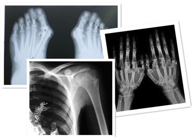 Filme térmico Fuji de X Ray de Digitas médico para o exame da radiografia