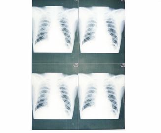 Good price Filme médico baixo branco do papel de X Ray Moistureproof para a impressora a laser de Sony/EPSON on-line