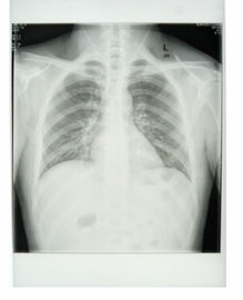 Costume filme médico do papel do raio X da base do branco de 25cm * de 30cm com materiais do ANIMAL DE ESTIMAÇÃO
