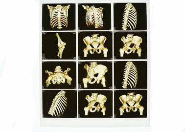 Good price Imagem latente diagnóstica branca Wearable da base X Ray, filme azul médico de X Ray do laser on-line