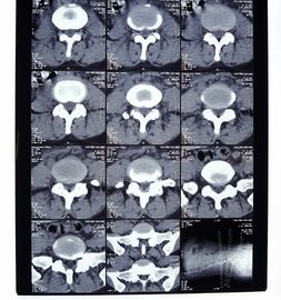 Filme de X Ray de Digitas da transparência, imagem latente médica AGFA/filme seco de Fuji X Ray