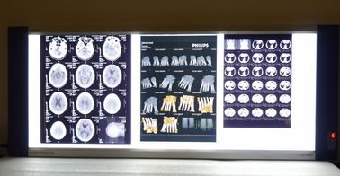 filmes secos da imagem latente médica do raio X de 10in * de 14in Digitas para as impressoras térmicas KND-F