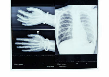 Good price Do calor de alta resolução seco médico do filme de Konida imagem latente de oposição on-line