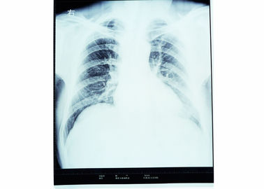 Good price Filme seco KND-A/KND-F da imagem latente médica da baixa névoa para impressoras térmicas on-line