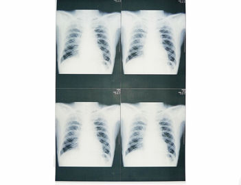 KND-A/filmes médicos X Ray de F