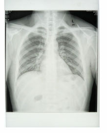 Good price O filme de raio X médico da impressora a laser de Konida CE de 11in x de 14in KND-K aprovou on-line