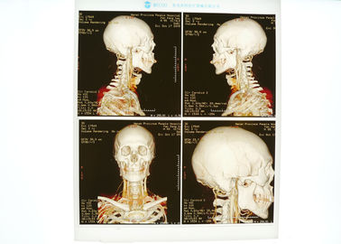 Good price Azul médico high-density do filme de X Ray para a impressora a laser de Konida on-line