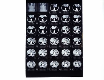 Good price Filmes médicos do raio de X, filme seco da imagem latente compatível com a impressora térmica para o CT/Dr./MRI on-line