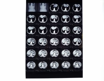 Filmes médicos do raio de X, filme seco da imagem latente compatível com a impressora térmica para o CT/Dr./MRI