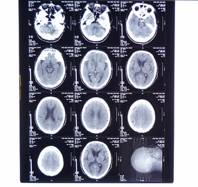11in * a imagem latente médica seca do raio X de 14in filma KND-A para AGFA 5300, 5302, 5500, 5502, 3000