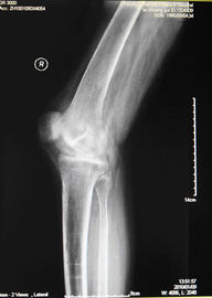 Good price Filme seco médico KND-A da imagem latente da agudeza alta para AGFA 5300, 5302, 5500, 5502, 3000 on-line